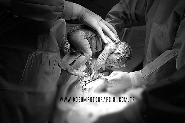 dogum-fotograflari-istanbul-9