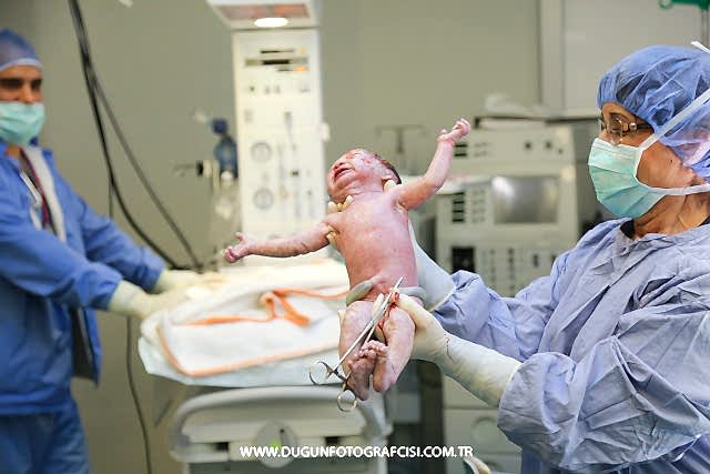 doğum fotoğrafçısı1