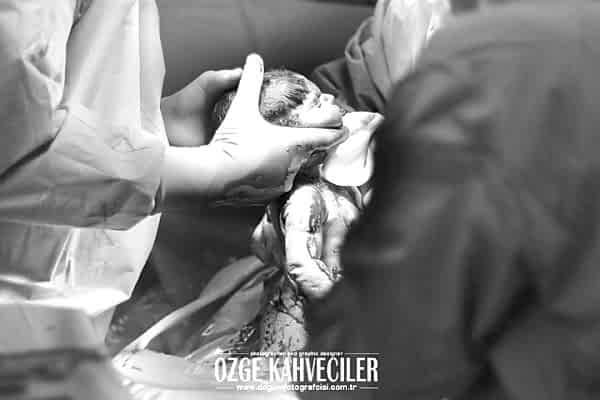 amerikan-hastanesi-dogumfotografcisi copy