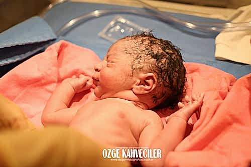 koç üniversitesi hastanesi doğum çekimleri 19