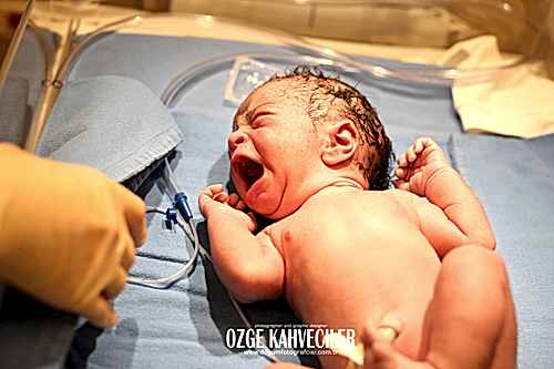 koç üniversitesi hastanesi doğum çekimleri 20
