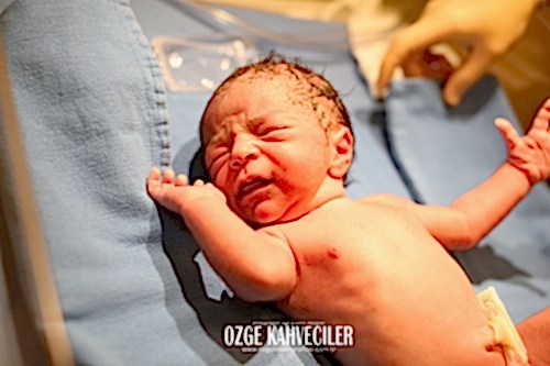 koç üniversitesi hastanesi doğum çekimleri 24